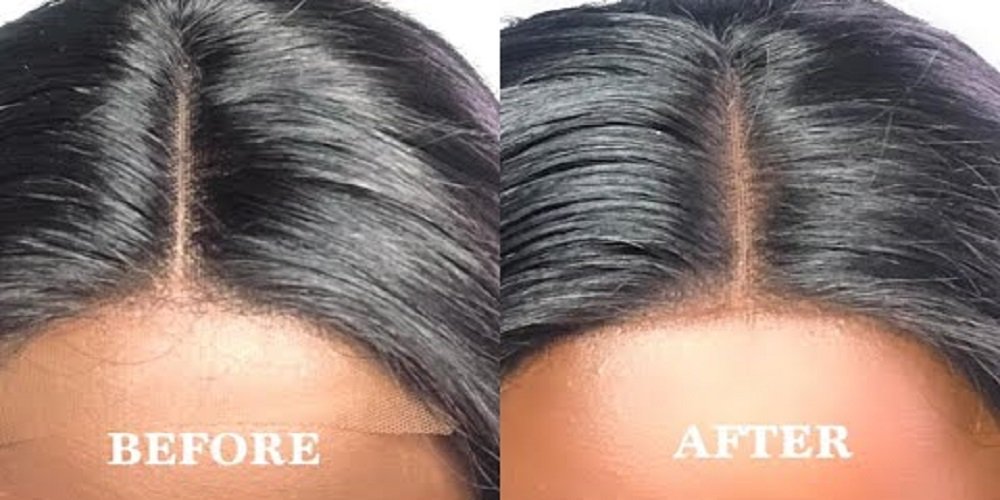 How can you fix a lace frontal lift?